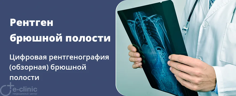Рентген брюшной полости