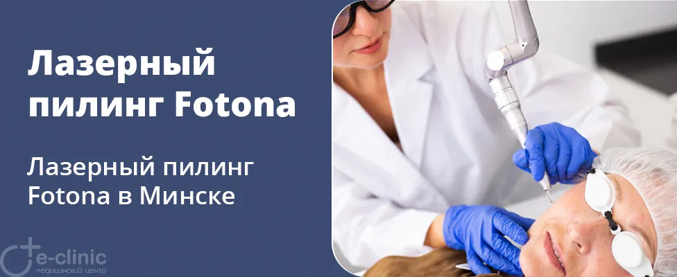 Лазерный пилинг Fotona