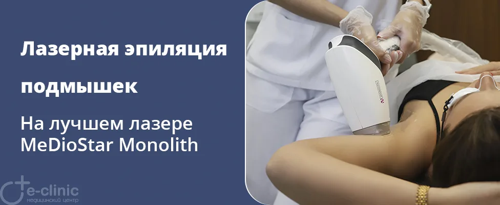 Лазерная эпиляция подмышек