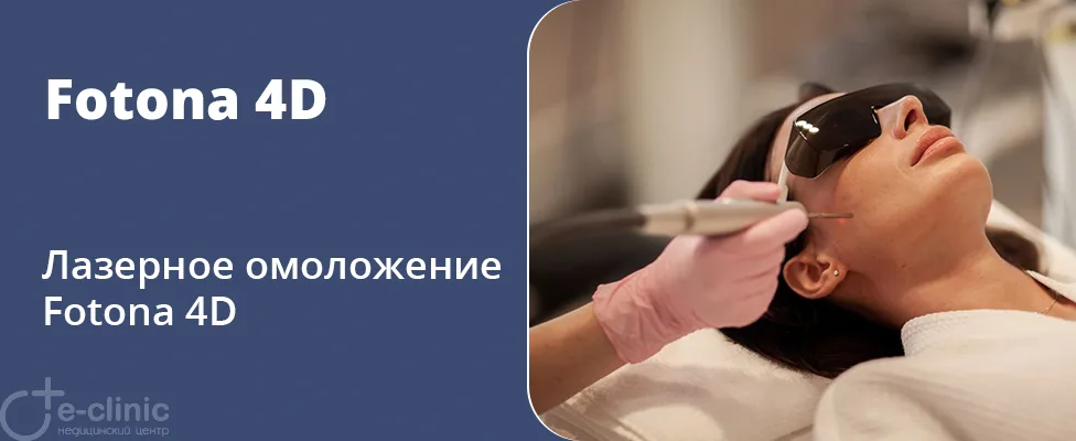 Лазерное омоложение Fotona 4D
