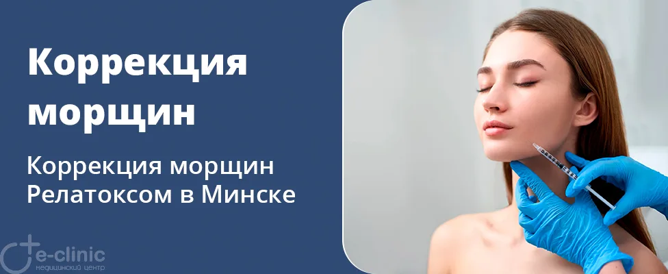 Коррекция мимических морщин препаратом Релатокс