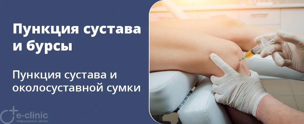 Пункция сустава и околосуставной сумки