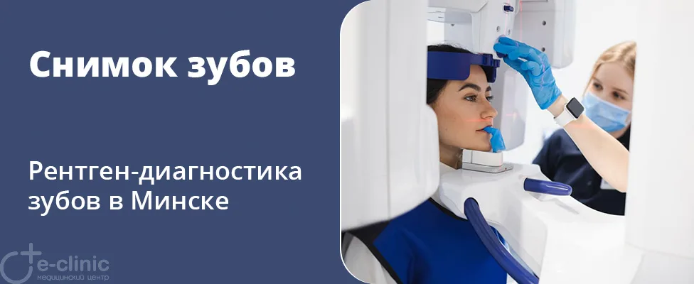 Снимок зубов КЛКТ (3D снимок зубов)