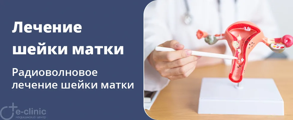 Радиоволновое лечение фоновых заболеваний шейки матки