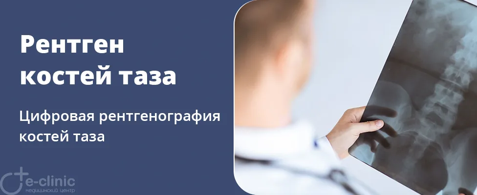 Рентген костей таза