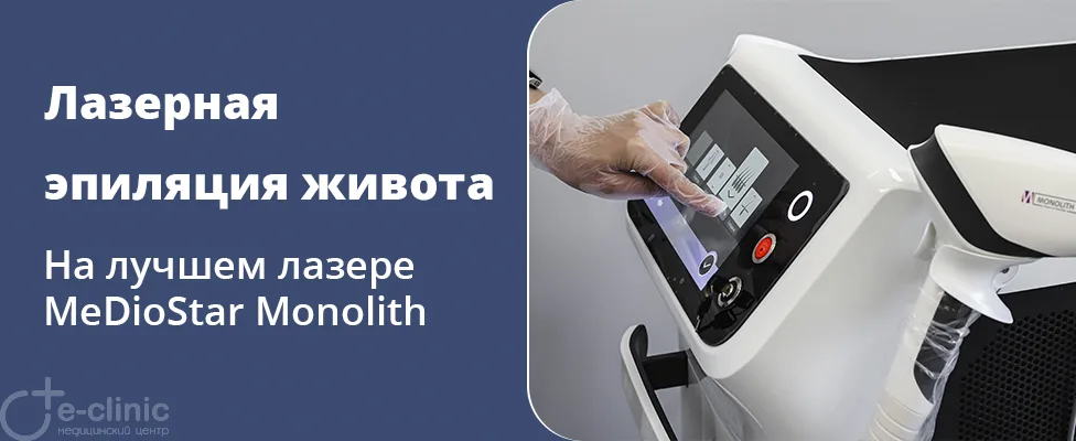 Лазерная эпиляция живота