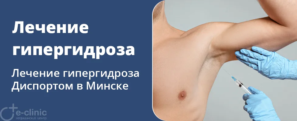 Лечение гипергидроза препаратом Диспорт