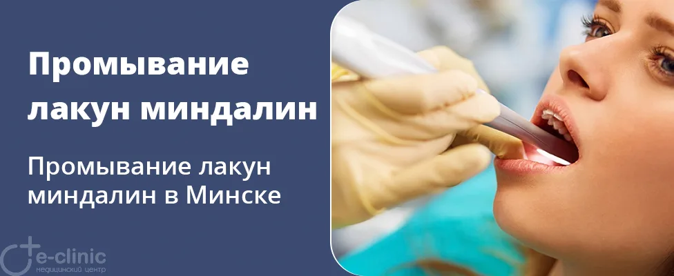 Промывание лакун миндалин