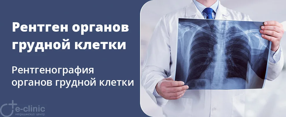Рентген органов грудной клетки