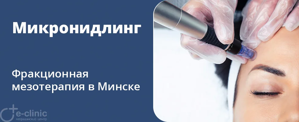 Микронидлинг