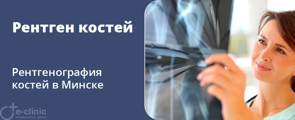Рентген костей