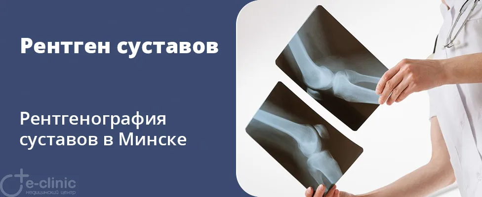 Рентген суставов