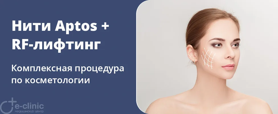 Лифтинг нитями Aptos + микроигольчатый RF-лифтинг