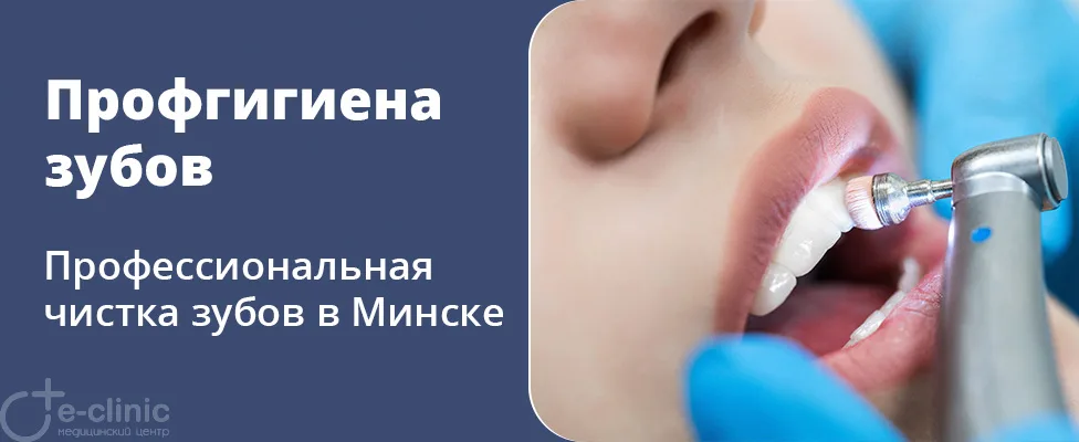 Профгигиена зубов