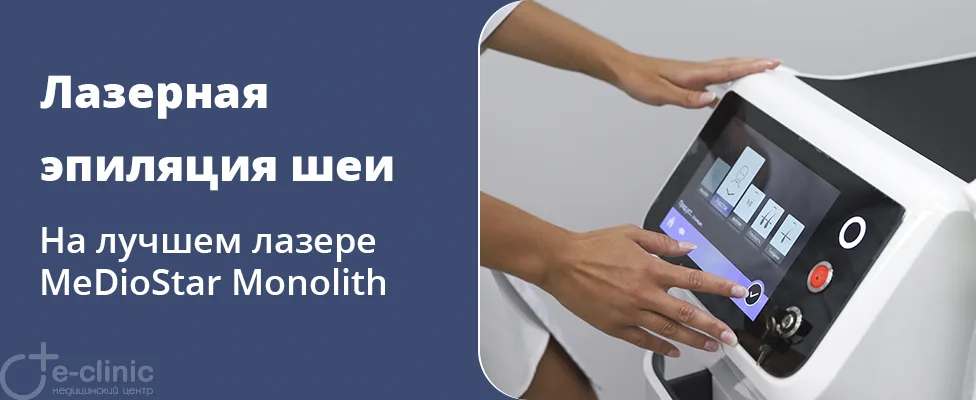 Лазерная эпиляция шеи