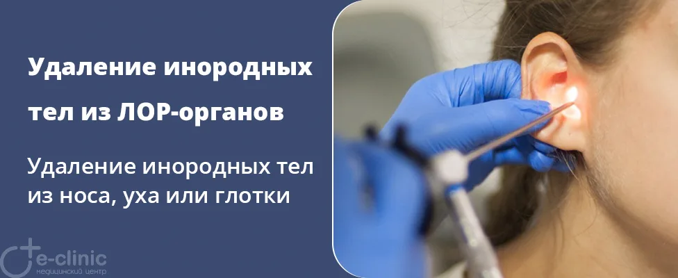 Удаление инородных тел из ЛОР-органов