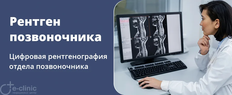 Рентген позвоночника