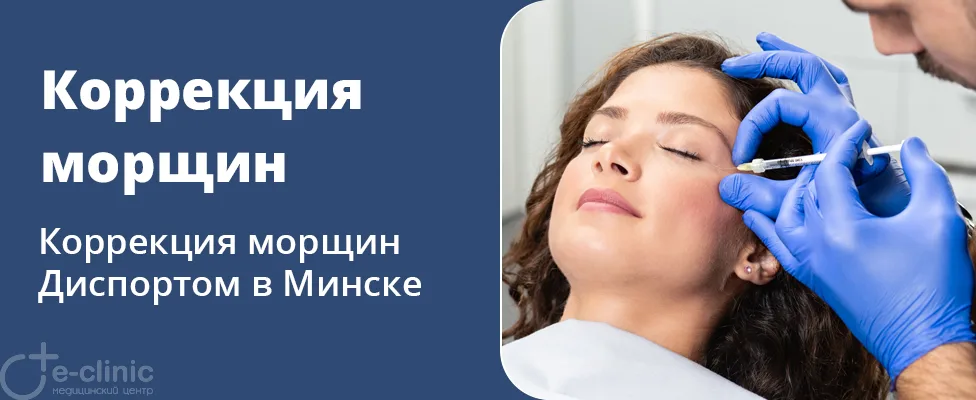 Коррекция мимических морщин препаратом Диспорт