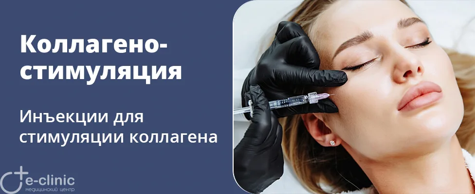 Коллагеностимуляция