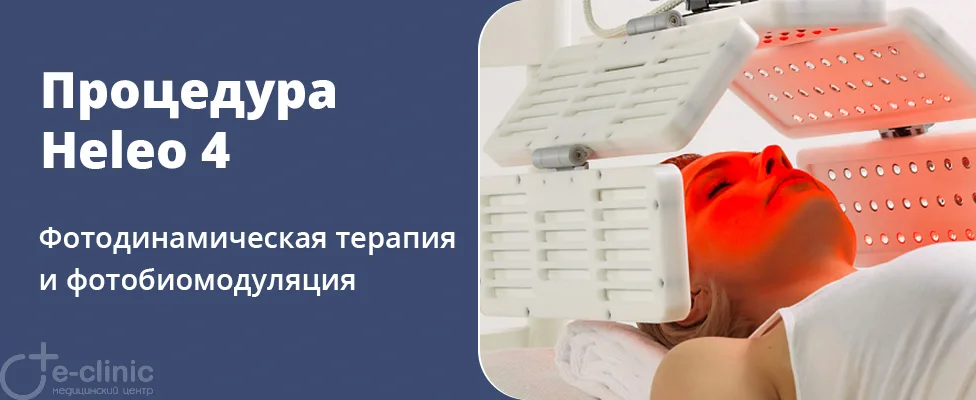 Фотодинамическая терапия Heleo4
