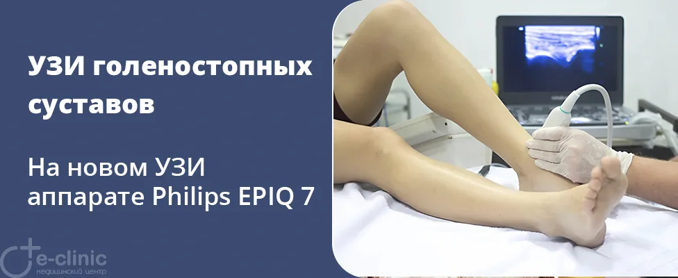 УЗИ голеностопных суставов