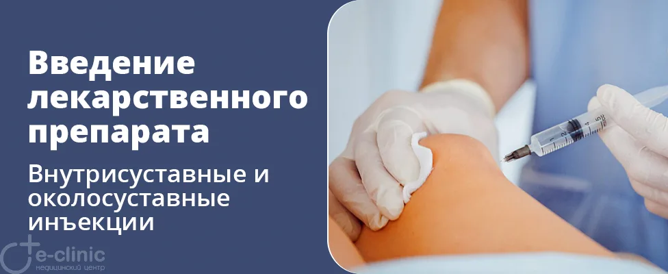 Внутрисуставное и околосуставное (периартикулярное) введение лекарственного препарата