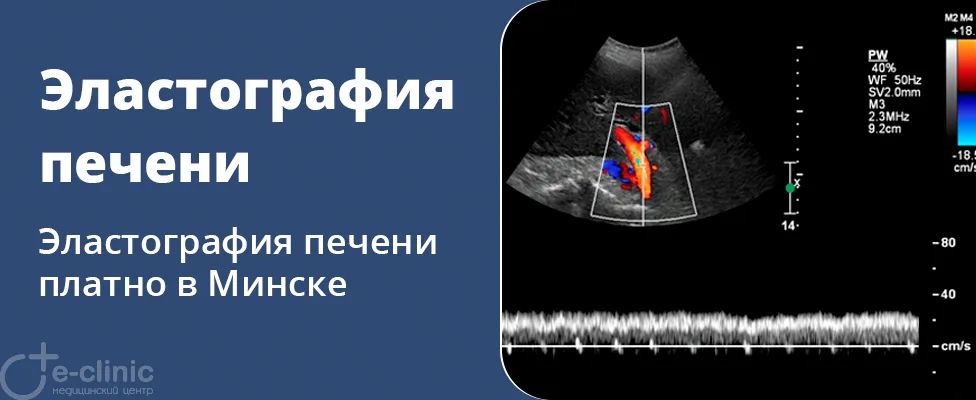 Эластография печени