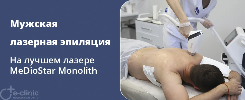 Мужская лазерная эпиляция