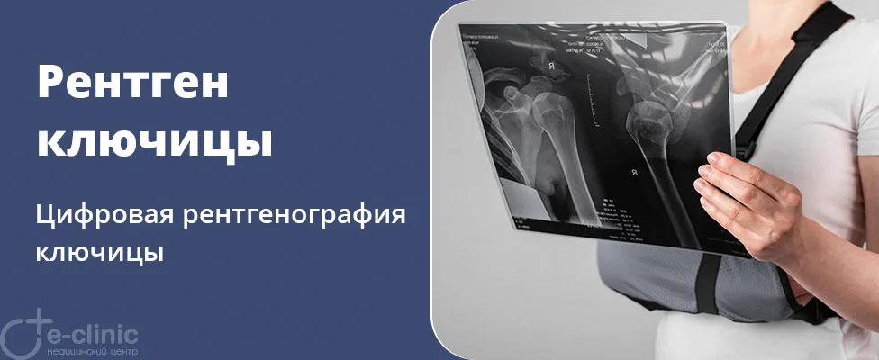 Рентген ключицы