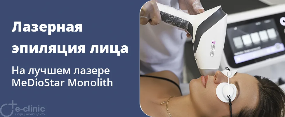 Лазерная эпиляция лица