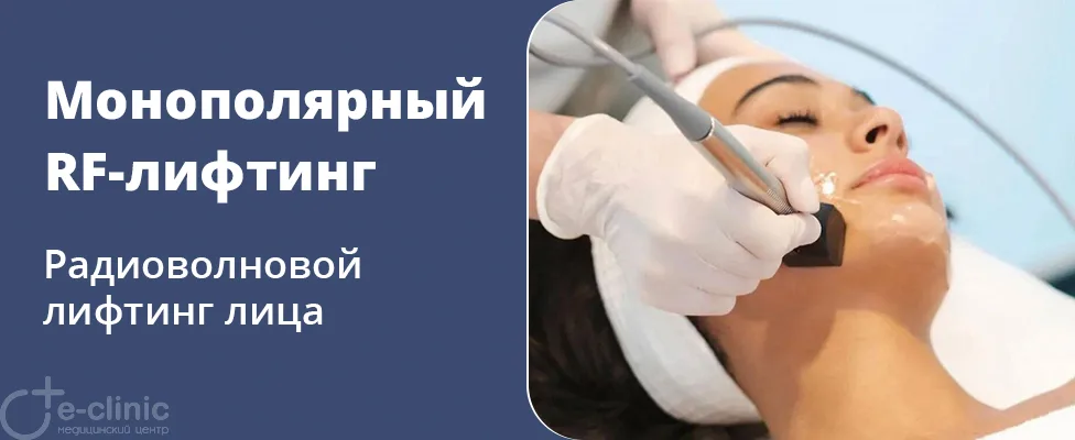 Монополярный RF-лифтинг