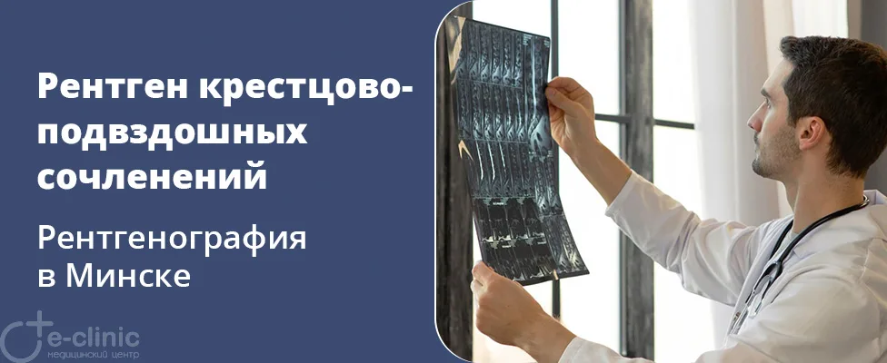 Рентген крестцово-подвздошных сочленений