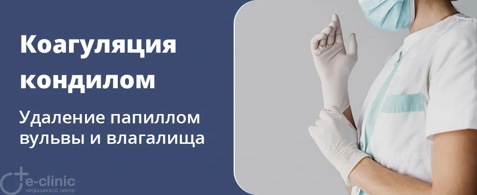 Коагуляция остроконечных кондилом и папиллом в области вульвы и промежности