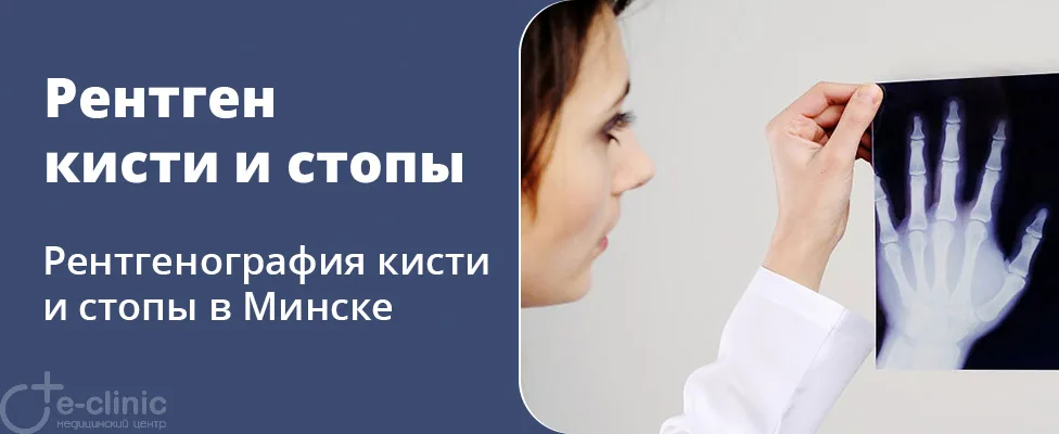 Рентген кисти и стопы