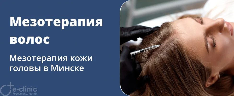 Мезотерапия волос