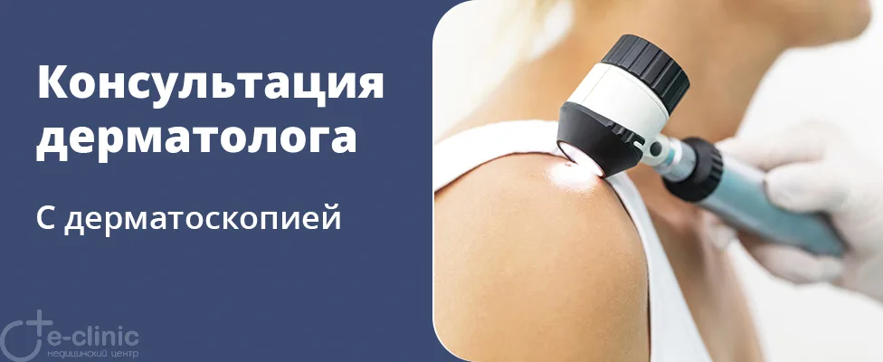 Консультация врача-дерматолога
