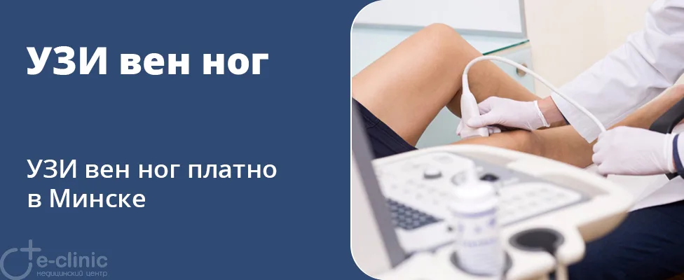 УЗИ вен ног