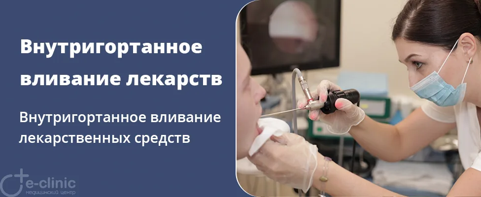 Внутригортанное вливание лекарственных средств