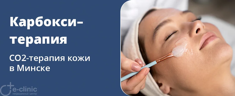 Карбокситерапия