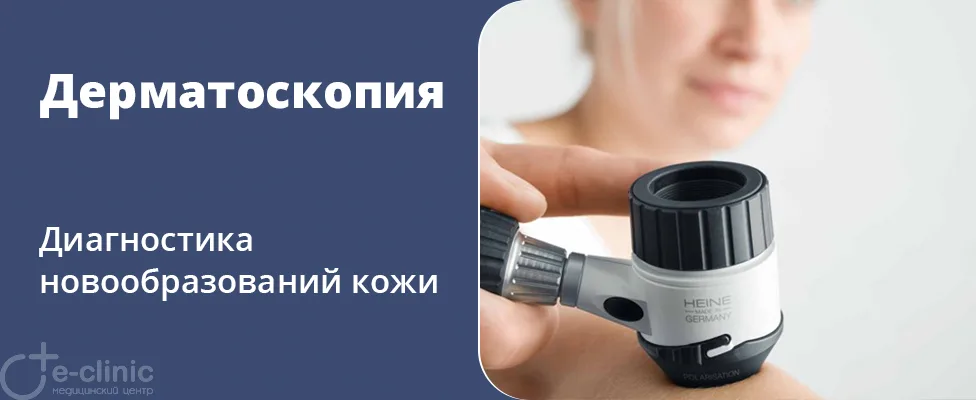 Дерматоскопия