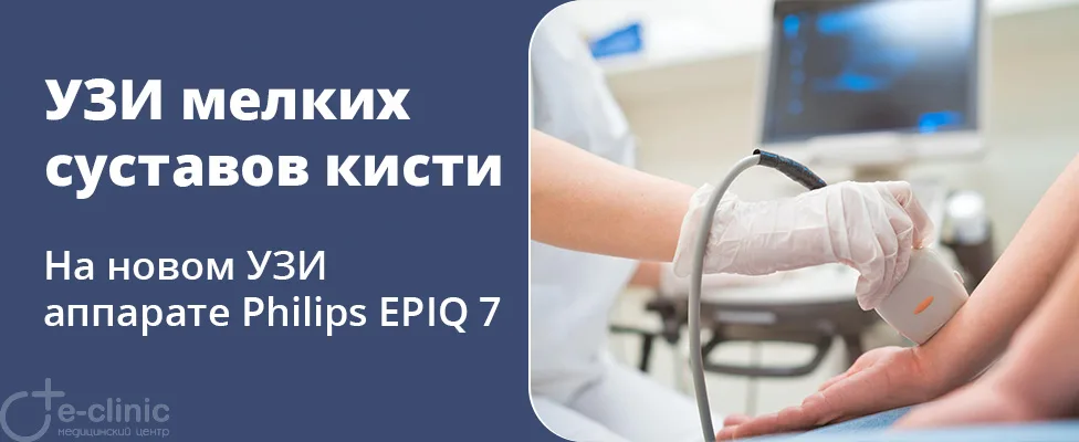 УЗИ мелких суставов кисти