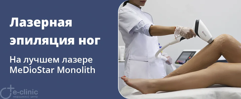 Лазерная эпиляция ног