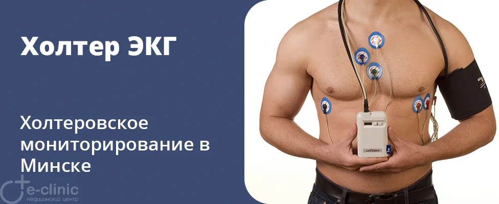 Холтер ЭКГ (холтеровское мониторирование)