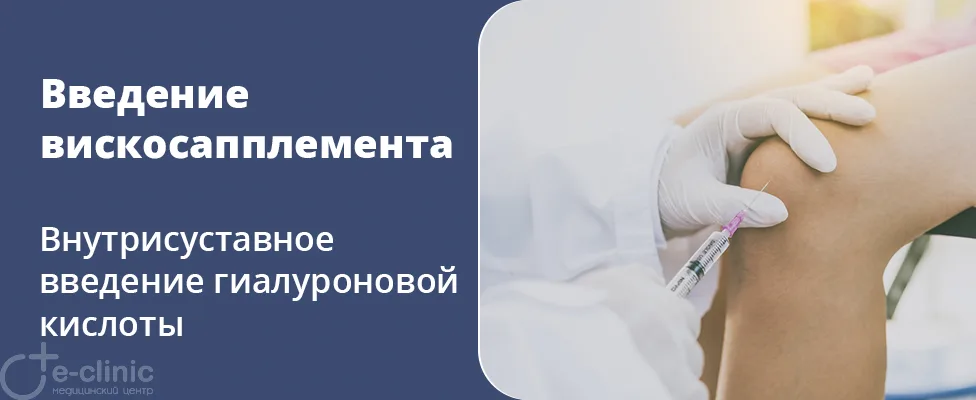 Вискосапплементарная терапия (внутрисуставное введение гиалуроновой кислоты)