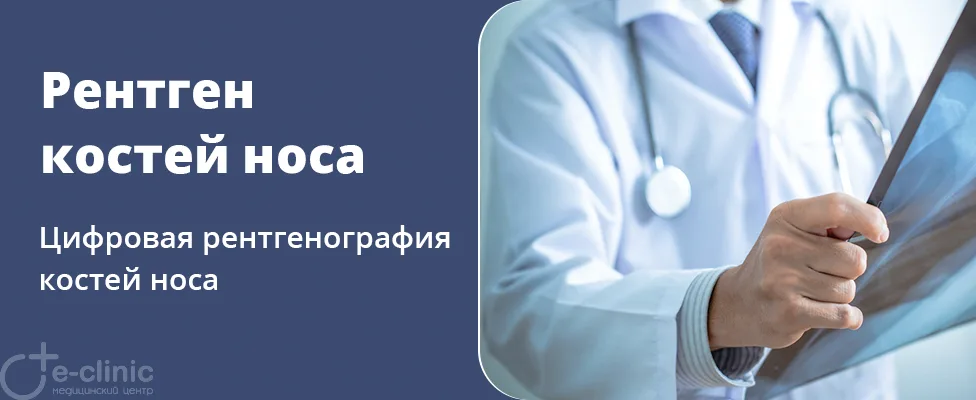 Рентген костей носа