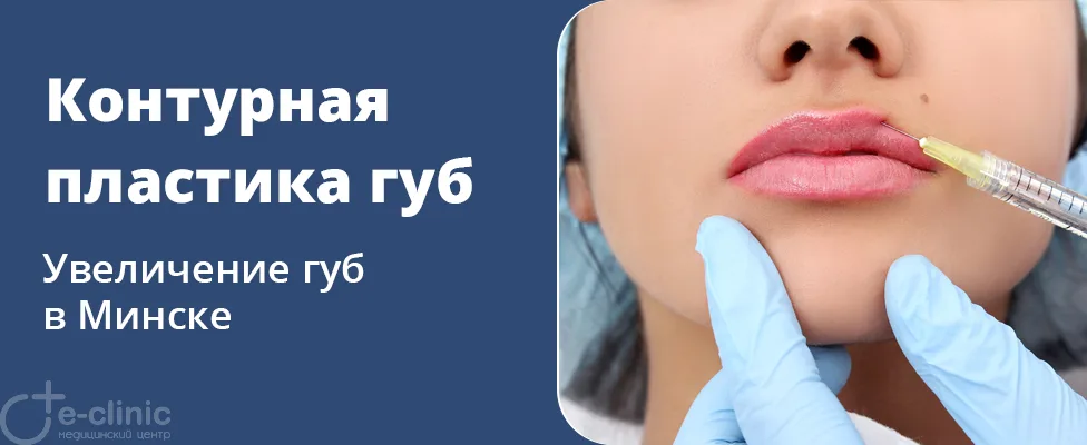 Увеличение губ, инъекционная контурная пластика губ