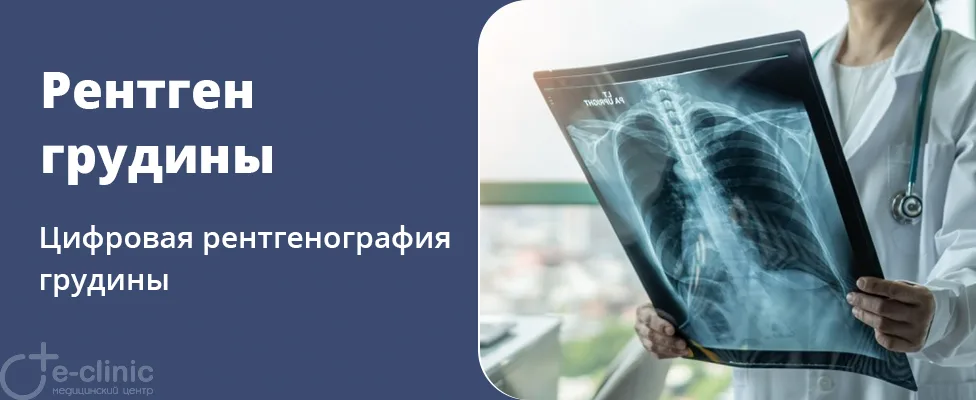 Рентген грудины