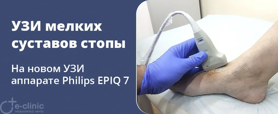УЗИ мелких суставов стопы