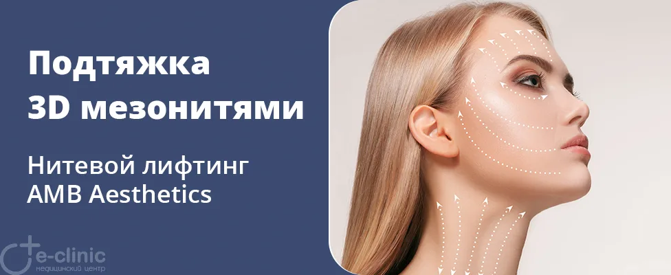 Подтяжка 3D мезонитями АМВ